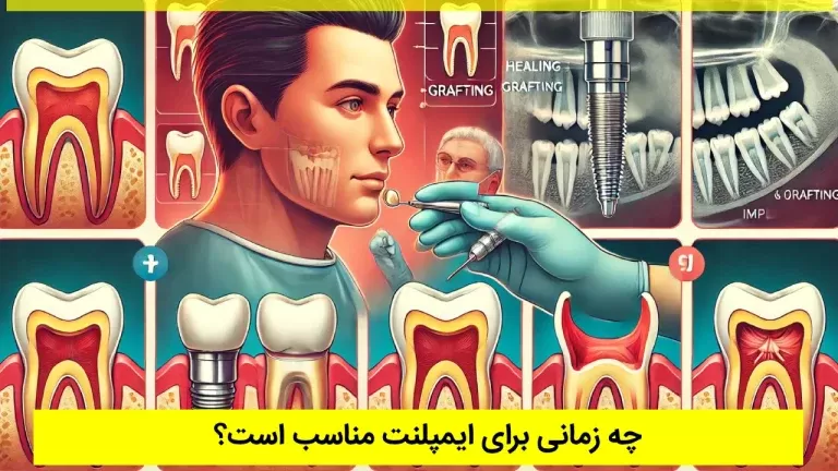 چه زمانی برای ایمپلنت مناسب است؟