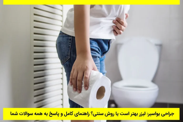 چه زمانی بواسیر باید عمل شود